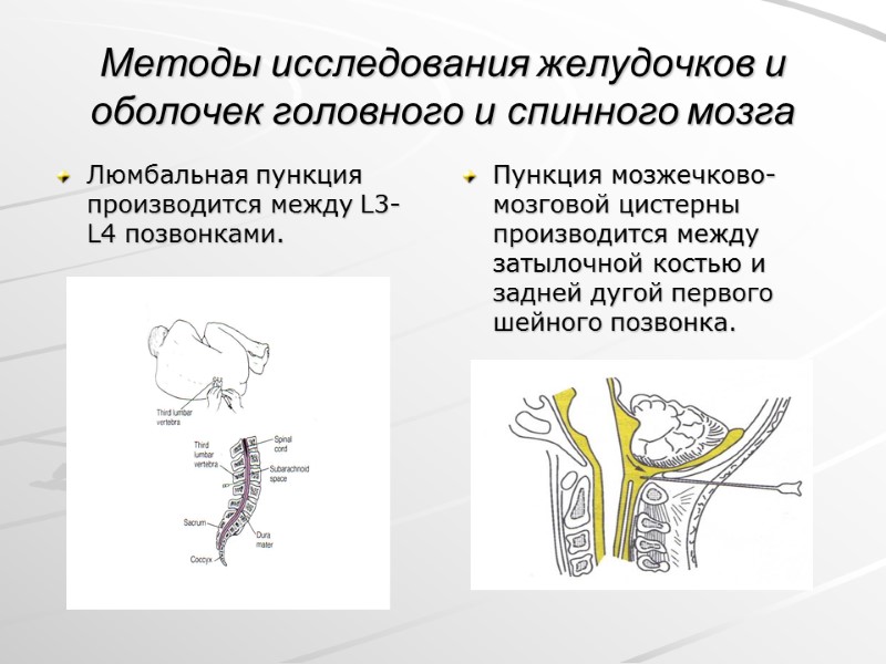 Методы исследования желудочков и оболочек головного и спинного мозга Люмбальная пункция производится между L3-L4